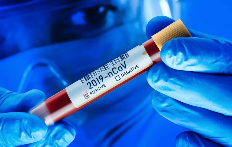 2019-nCoV Corona Virus Blood Test Concept