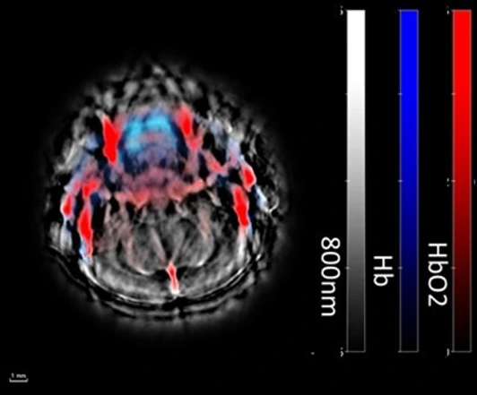 Wissenschaftsfoto Brain