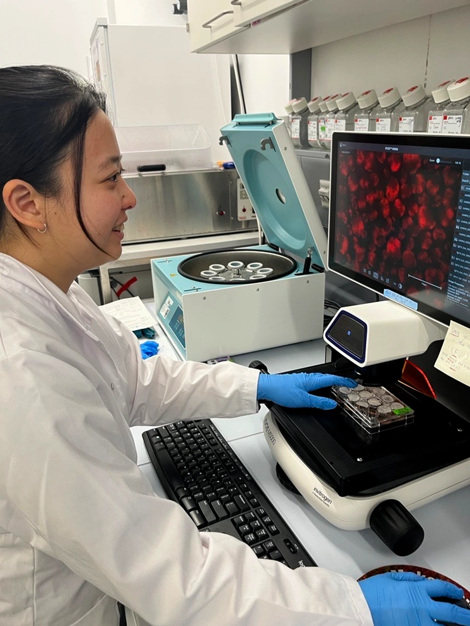 PhD Student working on Islet Transplants
