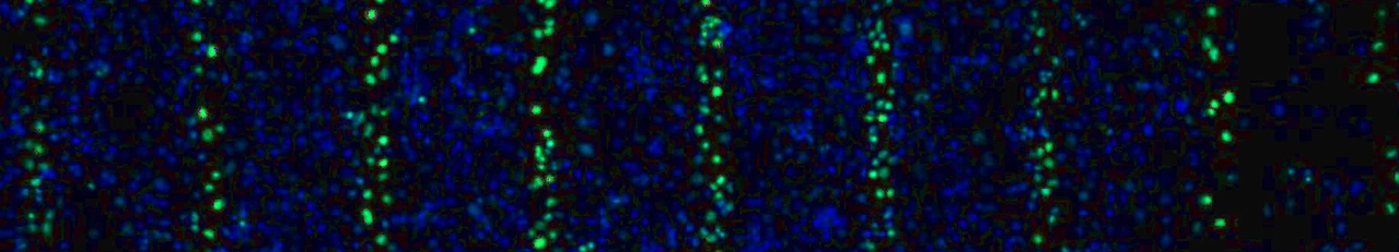 Graphik Bartzsch MRTgH2AX_1 Bild2a