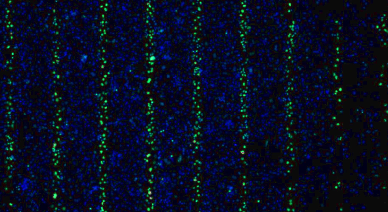 Graphik Bartzsch MRTgH2AX_1 Bild2a