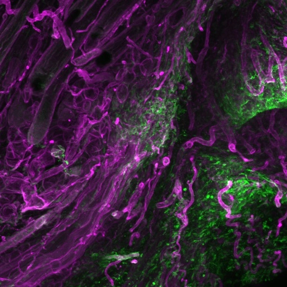 Fascia cells in wound healing