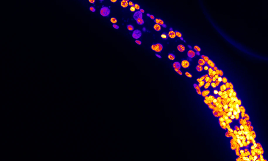 Cabianca_Celegans_Larvae2