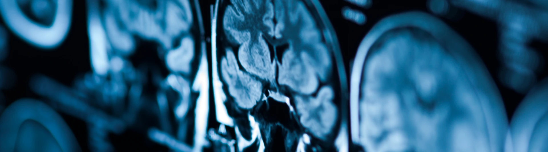The X-ray of the human brain closeup image