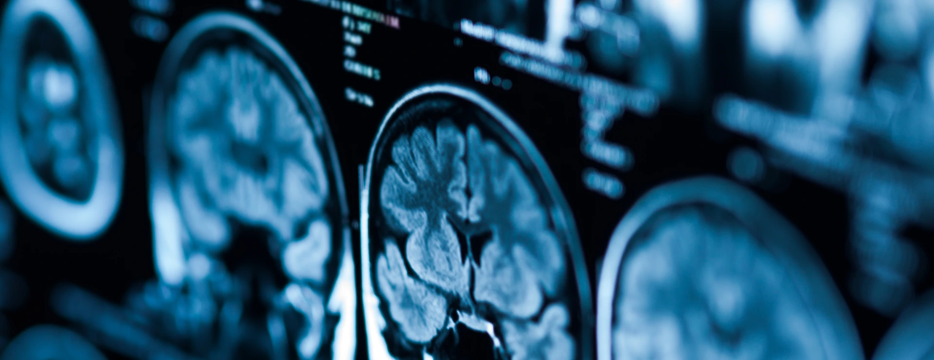 The X-ray of the human brain closeup image