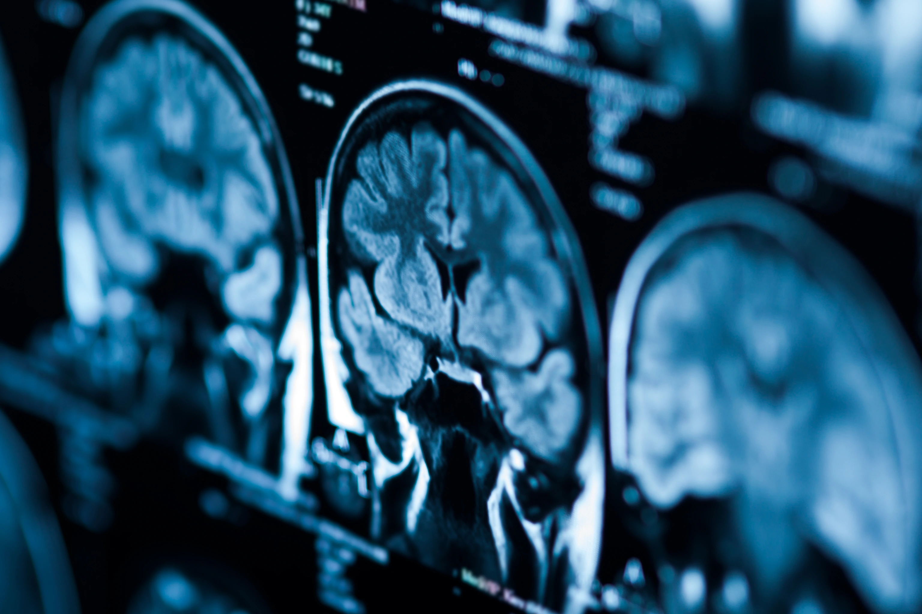 The X-ray of the human brain closeup image