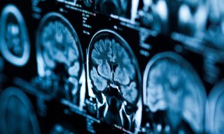 The X-ray of the human brain closeup image