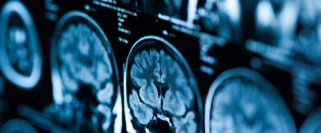 The X-ray of the human brain closeup image