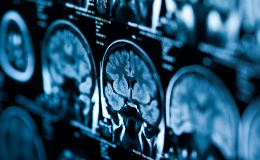 The X-ray of the human brain closeup image