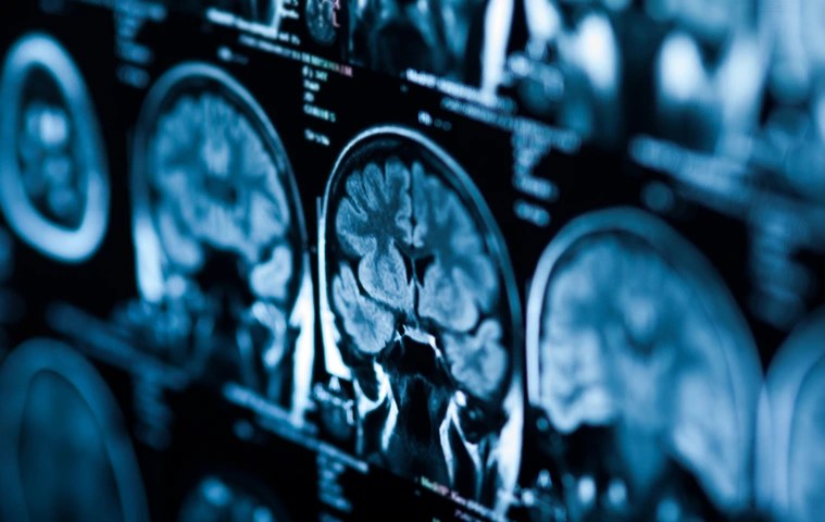 The X-ray of the human brain closeup image