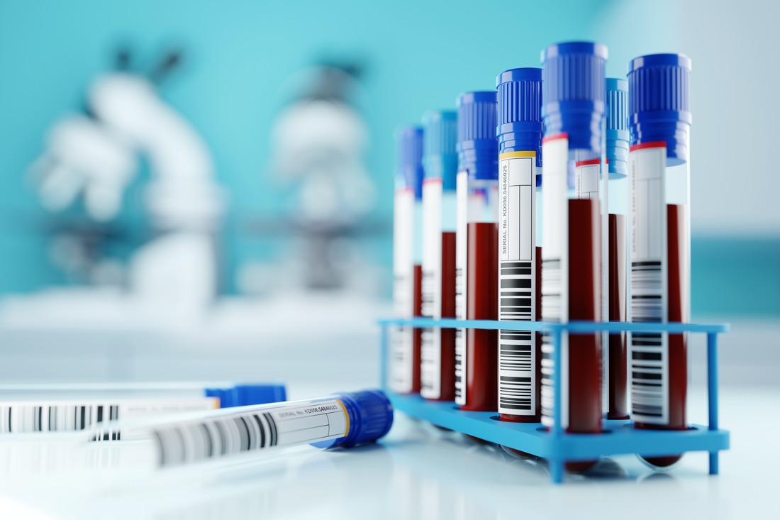 Allergietest in der Schwangerschaft