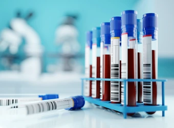 Allergietest in der Schwangerschaft