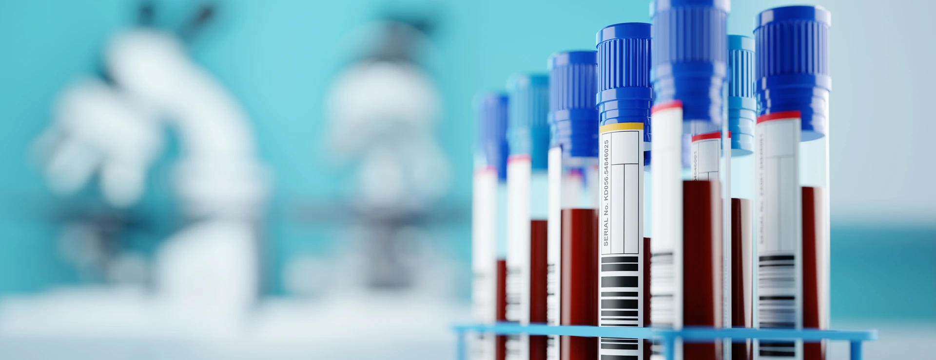 A row of human blood samples in a medical laboratory ready to be tested. healthcare background 3D illustration.