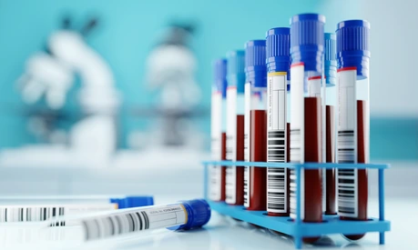 A row of human blood samples in a medical laboratory ready to be tested. healthcare background 3D illustration.