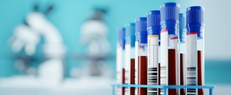 A row of human blood samples in a medical laboratory ready to be tested. healthcare background 3D illustration.