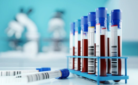 A row of human blood samples in a medical laboratory ready to be tested. healthcare background 3D illustration.