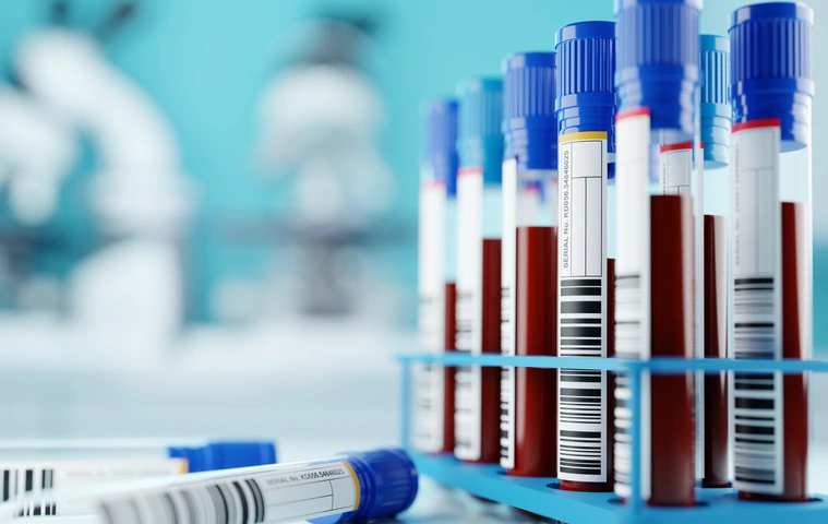 A row of human blood samples in a medical laboratory ready to be tested. healthcare background 3D illustration.