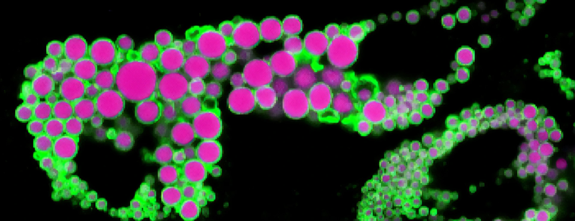 Human adipocyte