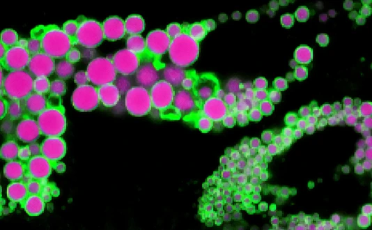 Human adipocyte