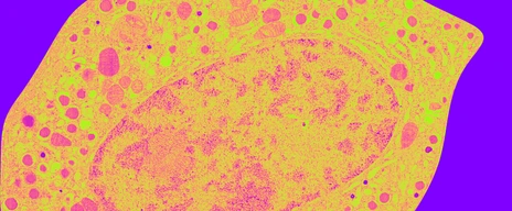 Betazelle_WarholStyle_IPI