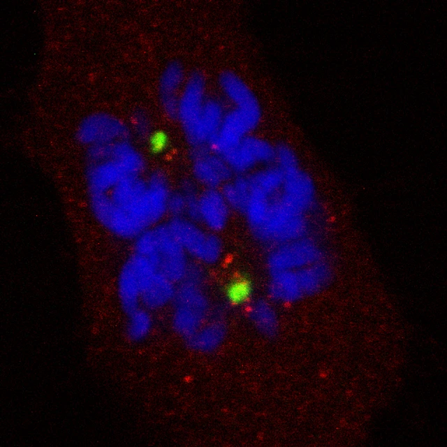 Teaser Picture ERC NeuroCentro