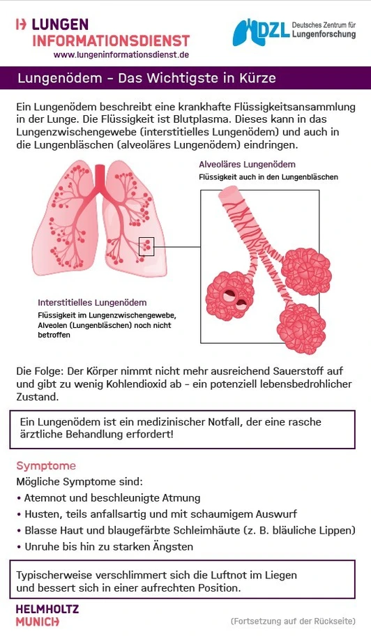 Voransicht Factsheet Lungenödem