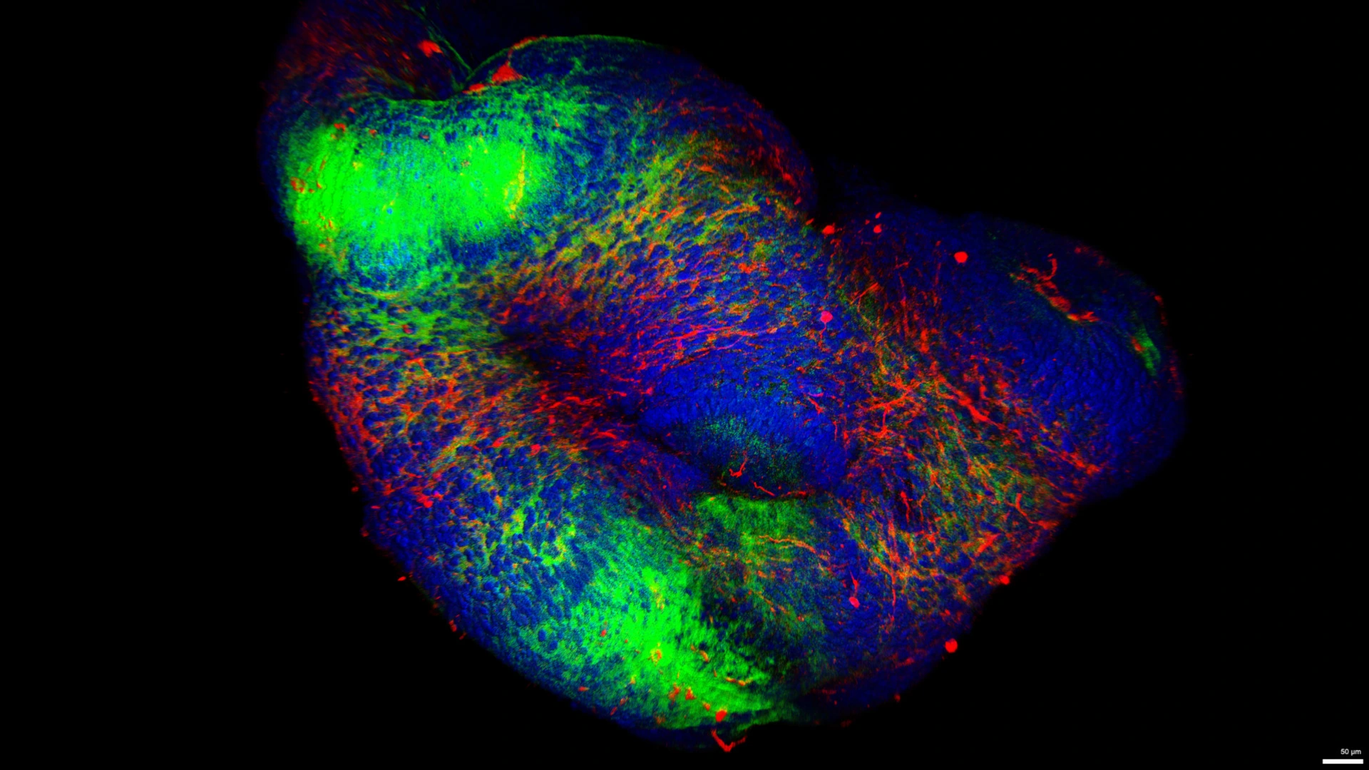 3D Organoids culture