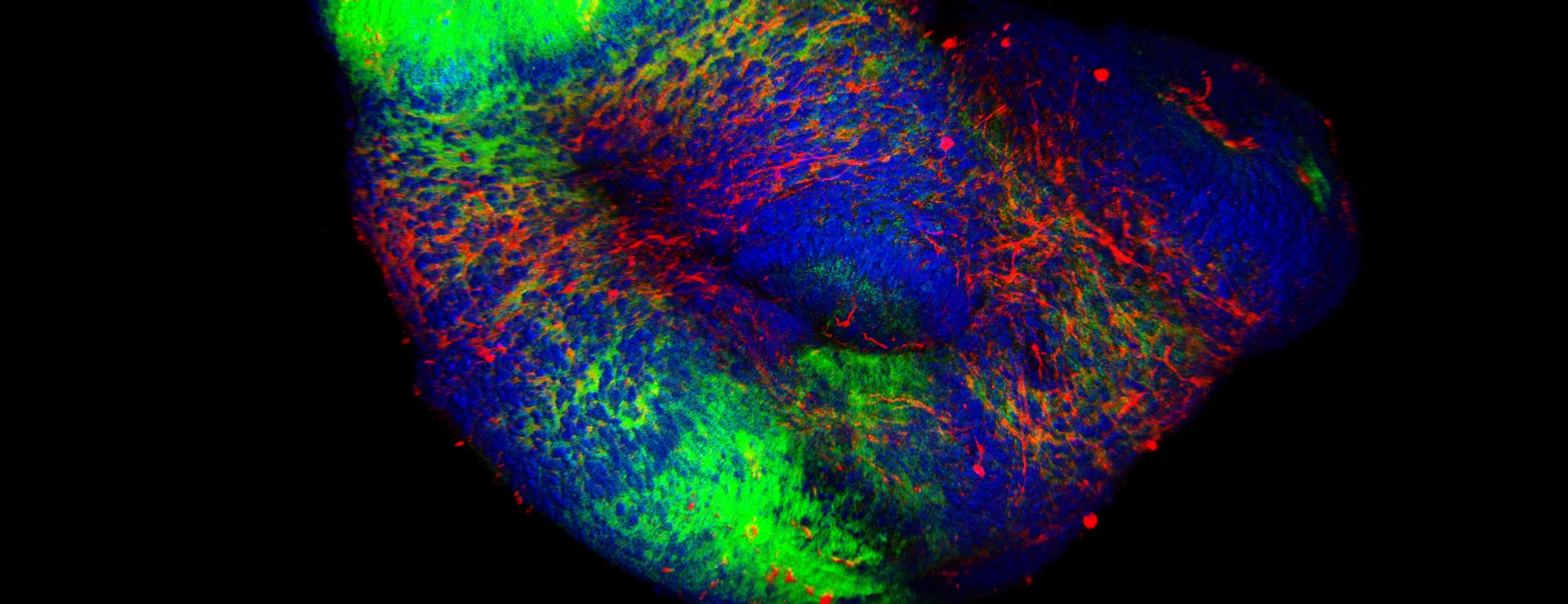3D Organoids culture