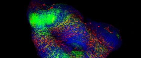 3D Organoids culture