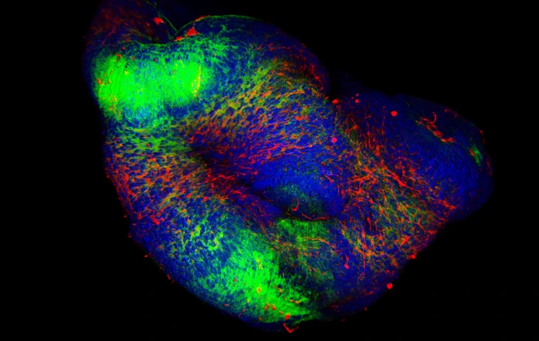 3D Organoids culture