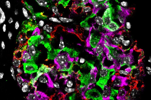 Pancreatic islet from a diabetic mouse