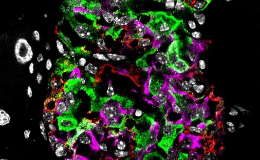 Pancreatic islet from a diabetic mouse