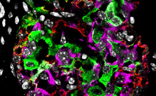 Pancreatic islet from a diabetic mouse