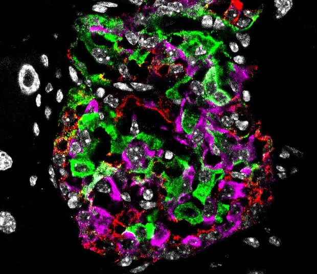 Pancreatic Islet from Diabetic Mouse
