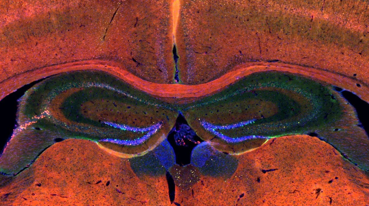 brain slice-screenshot-3_Shiqi Zhang for IDR-H website