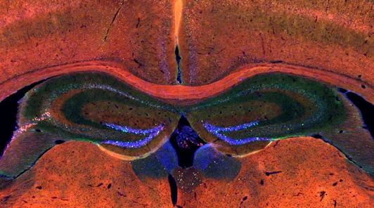 brain slice-screenshot-3_Shiqi Zhang for IDR-H website