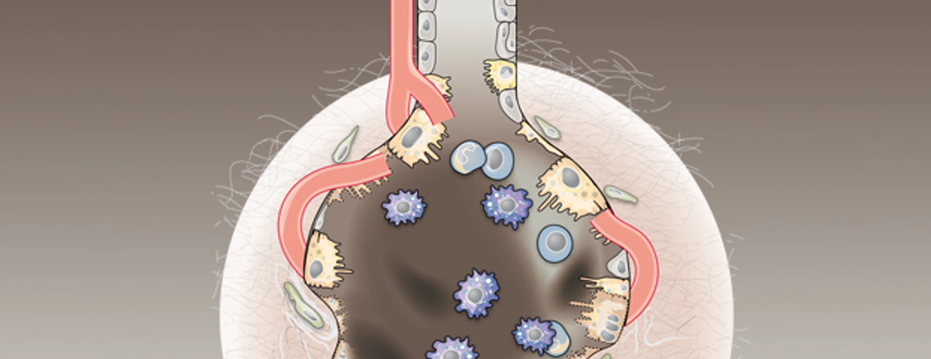 Graphic illustration of alveoli with COPD