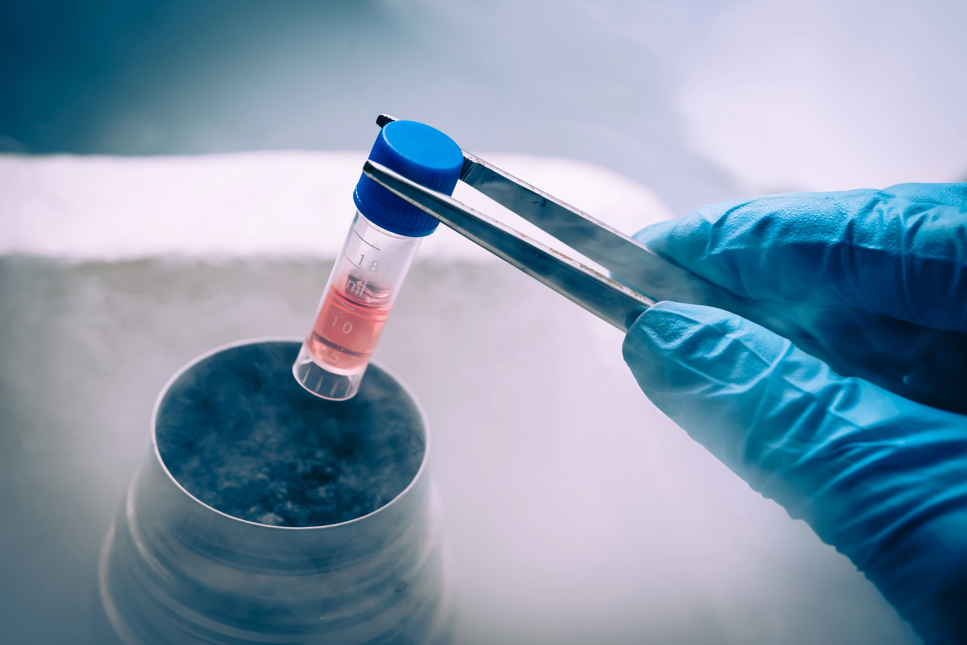 Eine tiefgefrorene Probe wird per Hand in einen Stickstoffbehälter gelegt
AdobeStock_77324536