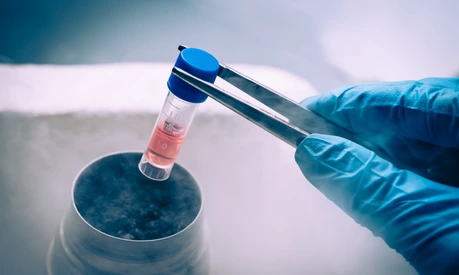 Tiefgefrorene Probe Probenaufbewahrung