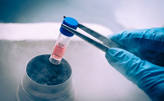 Tiefgefrorene Probe Probenaufbewahrung