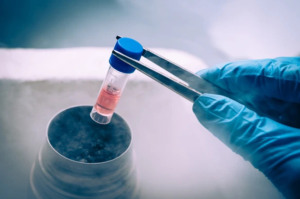 Tiefgefrorene Probe Probenaufbewahrung