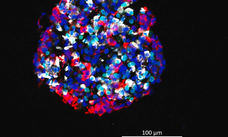 DAPI 405 GFP 488 RFP 555 GCG 633_3