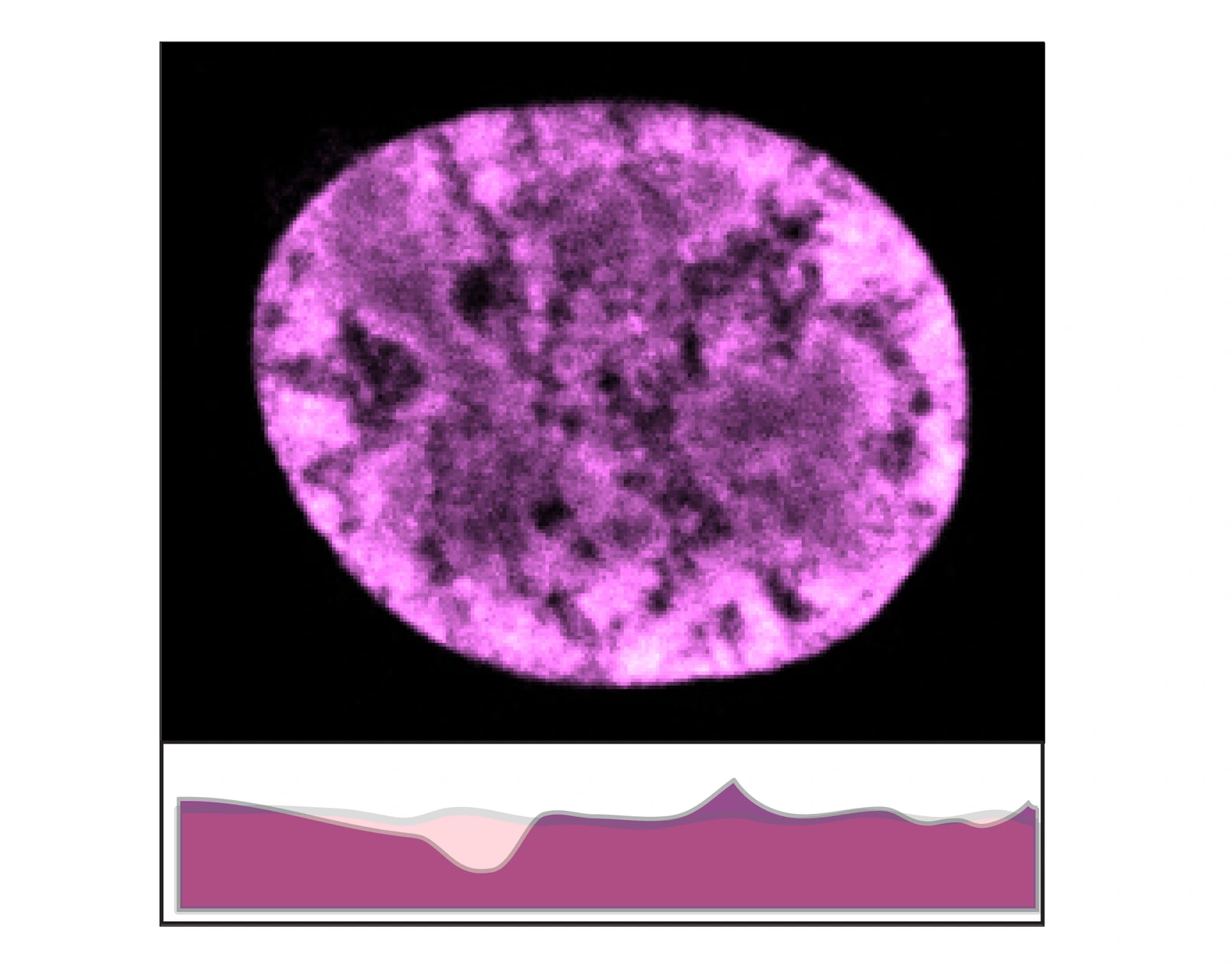 Brockers_H1_IFE_Webside