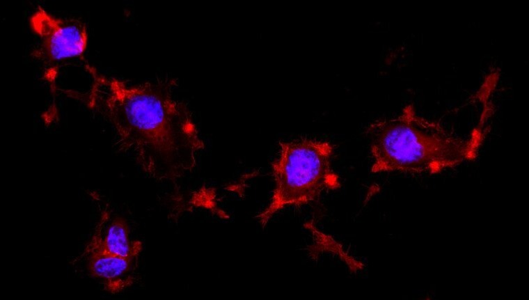 Fluorescence picture of a stauroporine cell assay