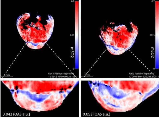 sO2 Metabolic Imaging