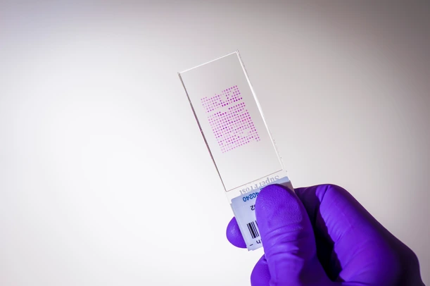 Tissue Micro Arrays