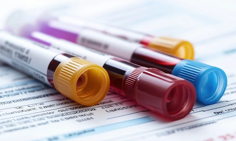 Color-Coded Blood Test Tubes on Medical Form. Close-up of color-coded blood test tubes placed on a laboratory form, representing healthcare diagnostics, blood analysis, and medical testing.