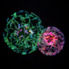 Heterochromatin Formation