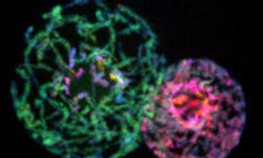 Heterochromatin Formation
