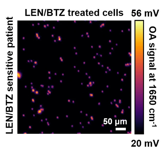 Misfolded proteins in myeloma cells